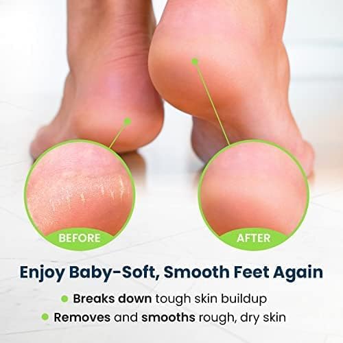 Foot Cure Foot Care/ Exfoliator & Callus Remover Pedicure Set – Includes Foot File for Dead Skin, Tea Tree Oil Foot Soak Salts, Urea Cream 40 Percent & Foot Callus Removal Gel – Made in USA