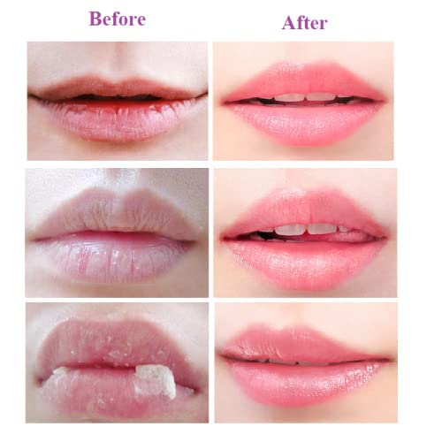 2PCS Lip Balm Honey Pot,Propolis Moisturizing Honey Lip Mask Lip Balm,Hydrating & Prevention Dry and Cracked Lip Scrubs Exfoliator