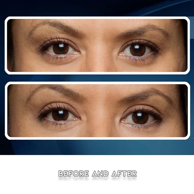 Premium Eye Lift (S/M Strips) Made in America. Instantly Lifts and Defines Droopy, Sagging or Hooded Eyes Safe for Daily Use