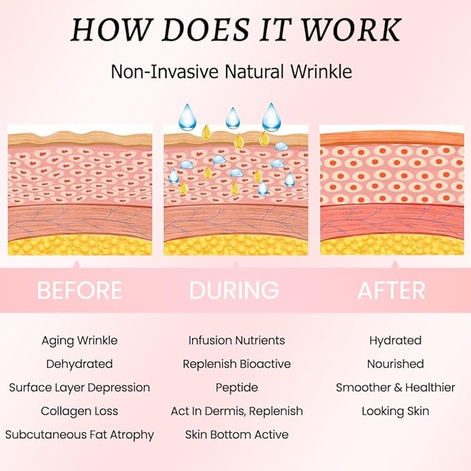 evpct 256Pcs Face Facial Medical Wrinkle Tapes Wrinkle Patches for Face Wrinkles Overnight, Smile Line Patches Face lifting tapes, Face oil Tape Smoothing Silicone face Forehead Wrinkle Patches