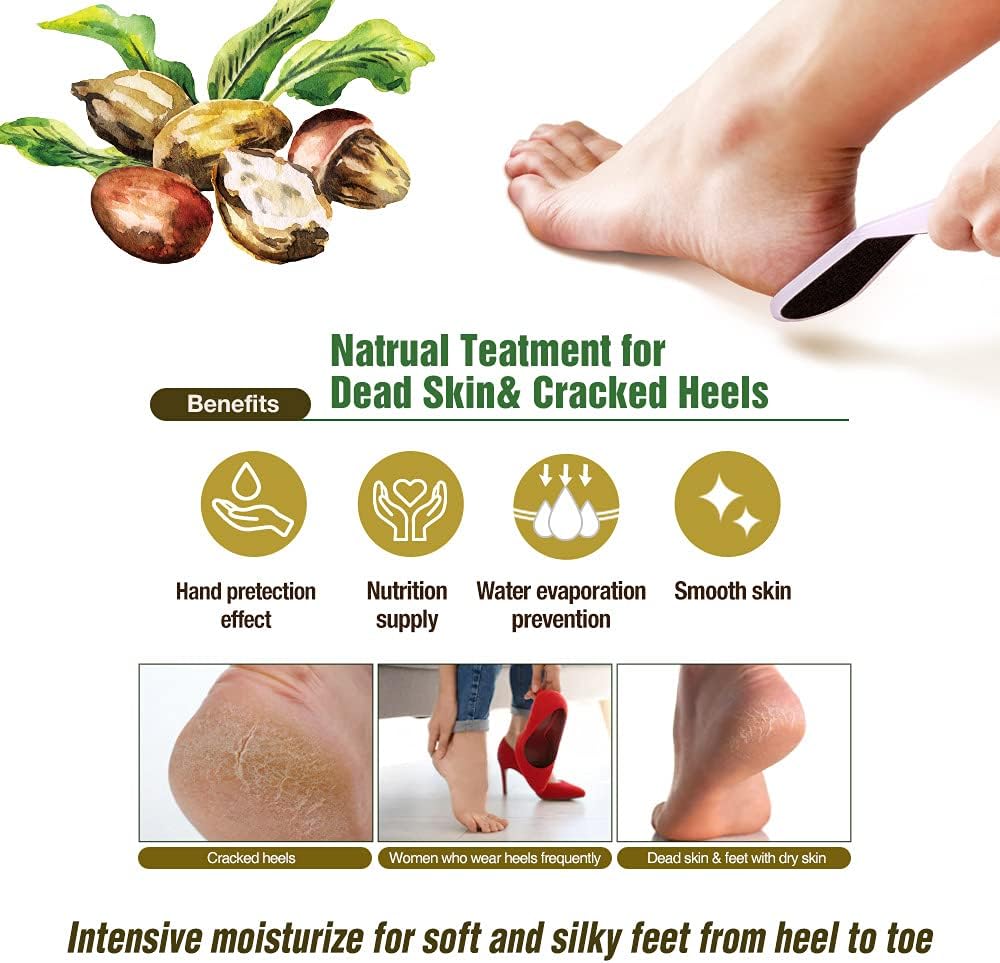 Epielle Hydrating Hand & Foot Masks 12 Pairs, Deep Moisturizing Socks & Gloves, Soften Dry Hands & Cracked Heels with Shea Butter & Jojoba Oil, Korean Skin Care, Foot Spa, Self Care Gifts for Women