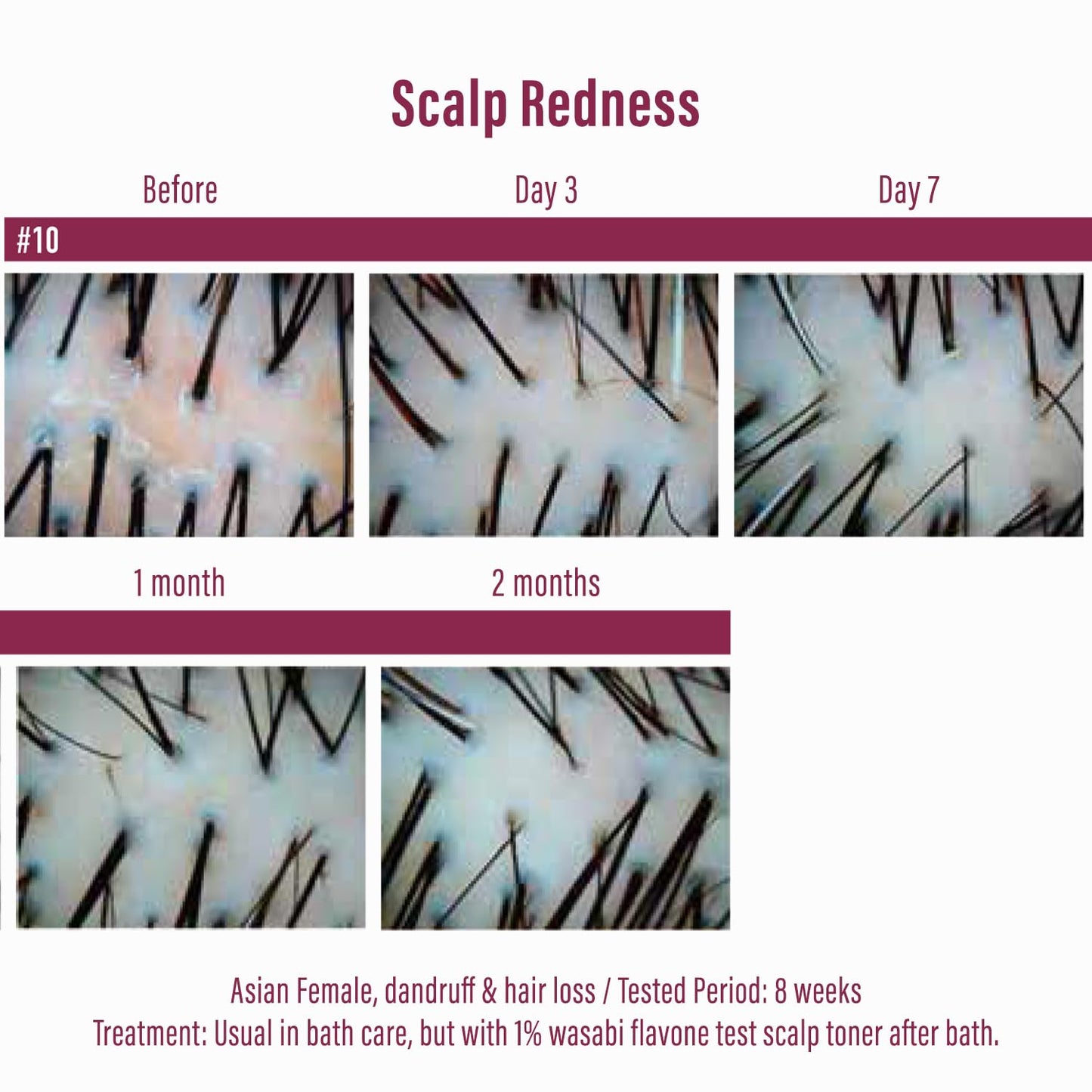 Moist Diane Thickening Conditioner for Men, Dry Itchy Scalp Treatment by Keratin, Ginseng Root & Protein, Argan Oil Conditioner for Women from Japan, 15.2 Fl Oz, EXTRA HAIR FALL CONTROL