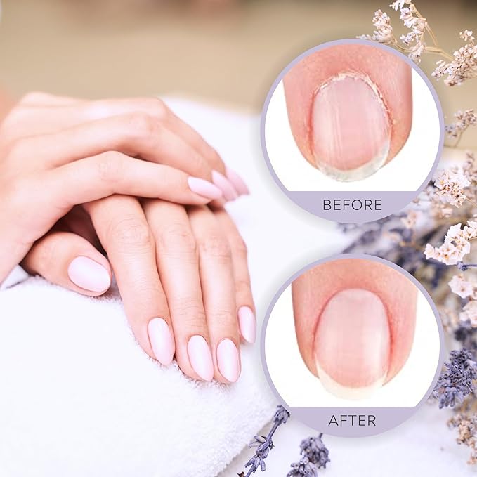 C CARE Pomegranate and Fig Roll-On Cuticle Oil | Natural Revitalizing Hydrating Nail Oil | Repaires Cuticles Overnight | Remedy For Damaged Skin And Thin Nails | Paraben Cruelty Free Formula | 10ml