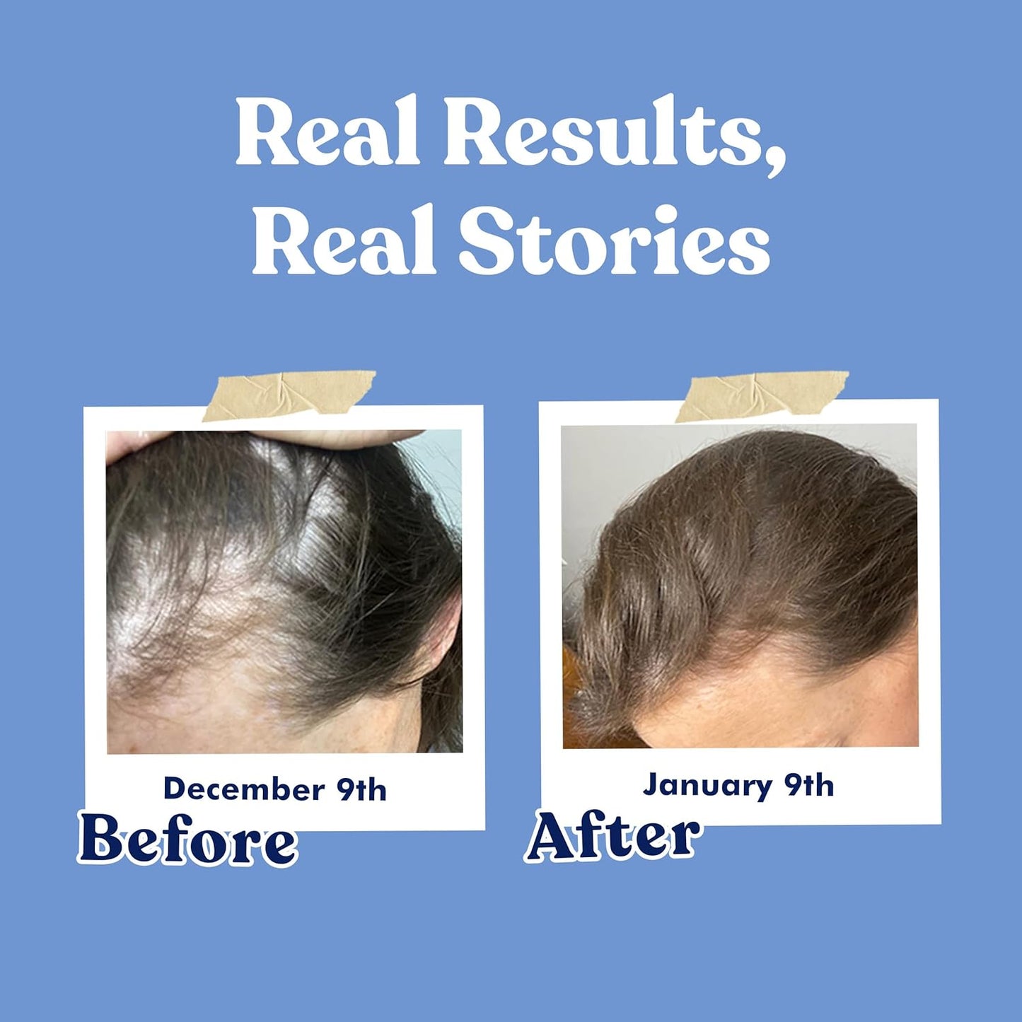 American Standard Supplements Biotin 20,000mcg with Keratin, Coconut Powder and Zinc, Biotin Supplement for Women and Men,120 Veggie Capsules, 120 Day Supply