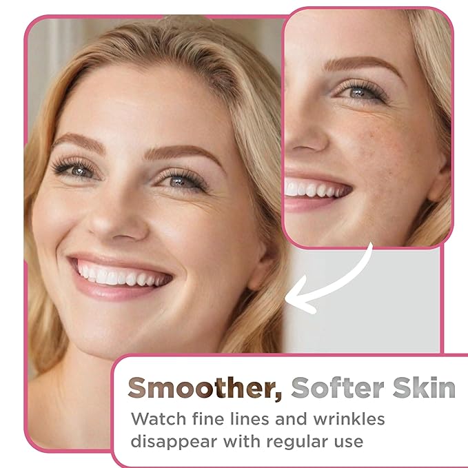 Advanced Ceramide Serum - Hydrating - Also Contains Vitamin C, Niacinamide - Ceramide Moisturizer - 1 Fl Oz - Pack of 1