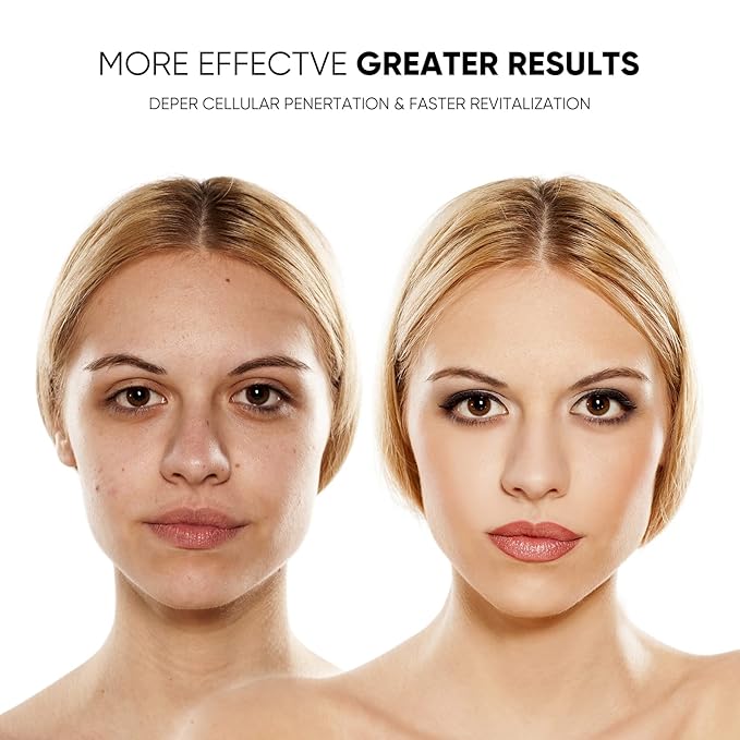 LED Face Mask Light Therapy Facial Photon Beauty Device with USB Cable 3 Colors LED Skin Care Treatment Mask for Facial Rejuvenation, Anti-Aging