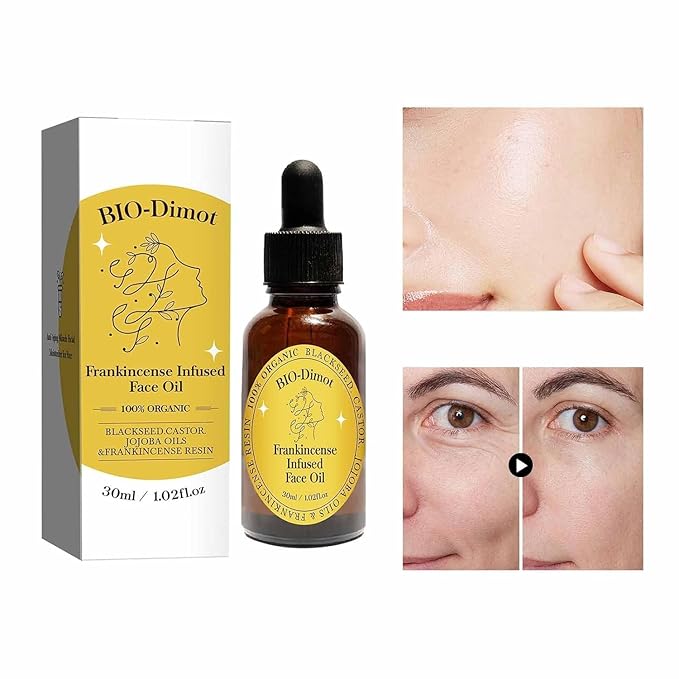Frankincense Resin Oil For Face,Frankincense Resin Infused Organic Black Seed & Jojoba Oils,Natural skin Care moisturizing, Facial Anti-Aging Moisturizing skin Serum (2)