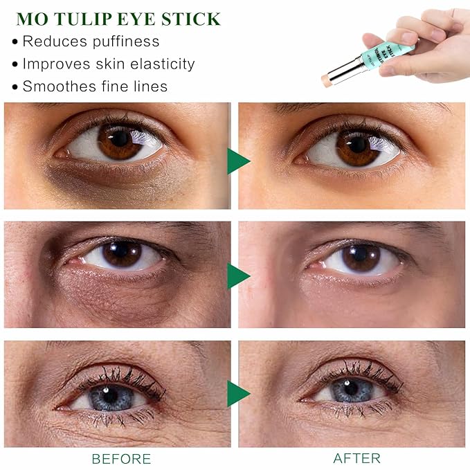 Retinol Eye Stick Balm, Retinol Eye Cream – Anti-Aging Formula Reduces Fine Lines, Dark Circles & Puffiness, Hydrates Delicate Skin – Visible Results in 4 Weeks, Gentle for Sensitive Skin