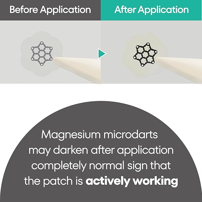 Magneisum Microdart Acne Patch for Early Stage Acnes - Fast Acting Microdart Pimple Patches for face - Zit patches for face