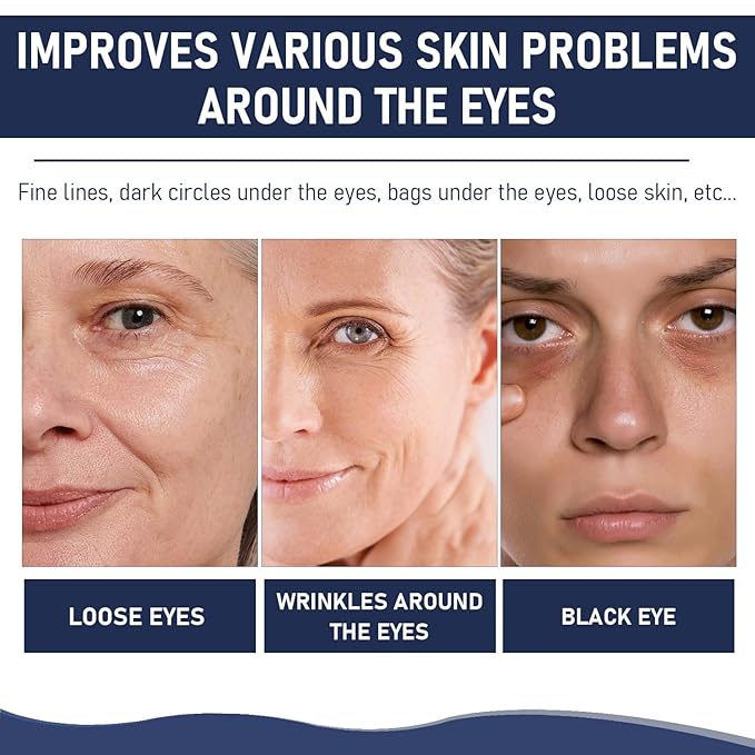 Rapid Reduction Eye Serum, Anti Aging Serum Visibly Reduces Under-Eye Bags, Sunlit Rose- Satin Finish, Nourishing Eye Serum, Suitable For All Skin Type(2PCS)