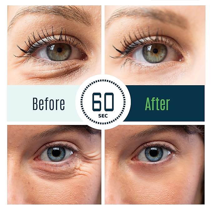 Instant Eye Treatment & Gel Bundle – Featuring Plant Stem Cells & Advanced Time Reverse Anti-Aging Eye Cream for Smooth Fine Lines, Wrinkles, and Dark Circles