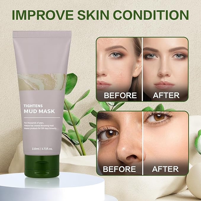 TLM Recovery Mud Mask | Relief Mud Mask | Korean Mud Masks for Face | Hydrating & Moisturizing Deep Pore Cleanser (With brush)