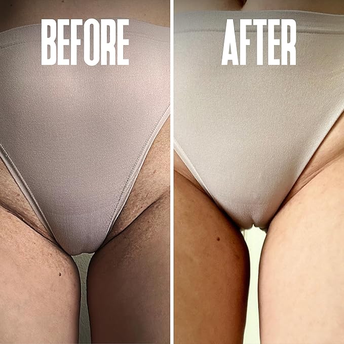 Save 18% on The Skin Care Solution For Dark Spots, Razor Bumps, Ingrown Hair & Razor Burns β Includes Our Ultra Potent Brightening + Razor Bumps Pads For an Ultra Clear & Glowing Skin