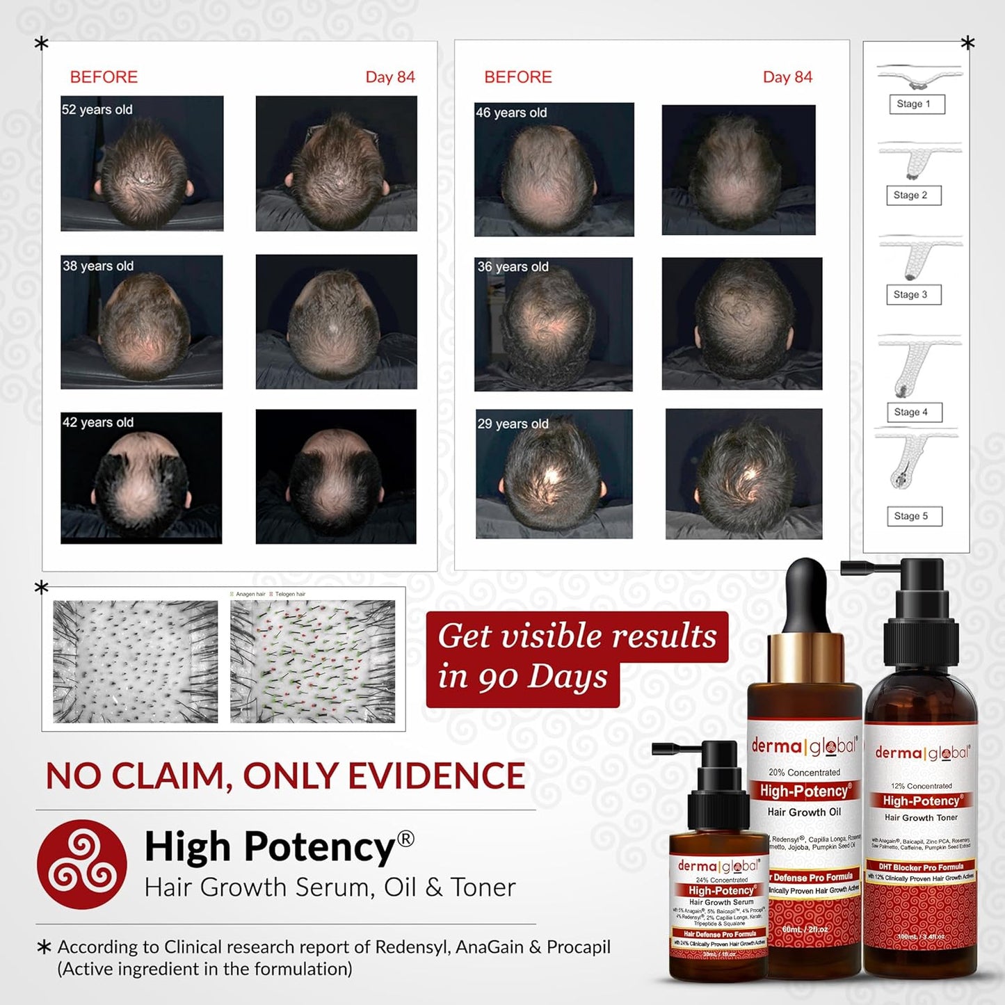 High Potency® Hair Growth Oil – Hair Defence Pro Formula | 20% Clinically Proven Actives including Procapil, Redensyl, Capilia Longa, Rosemary, Saw Palmetto, Jojoba, Pumpkin Seed Oil