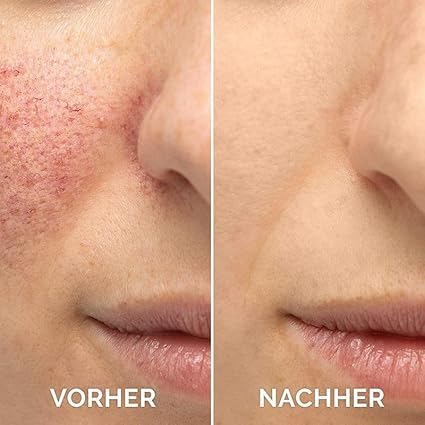 2PCS Vitamin C Facial Serum Essence, Hydration, Skin Moisturized, Vitamin C Serum, Anti Aging & Wrinkle Facial Serum（30ml / 1.01oz）