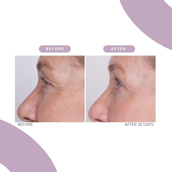 Serious Skincare - Reverse Lift Eye Cream Moisturizer with Peptides - Skin Firming Wrinkle Formula - Temporarily Lift & Firm Eye Lids and Eye Area – Women, Men - 1 Fl. Oz.