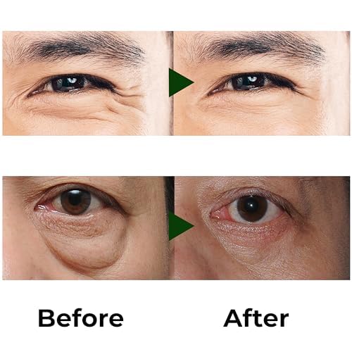 Abera Precision Eye Roller – Anti-Aging & Brightening Treatment for Men’s Eyes