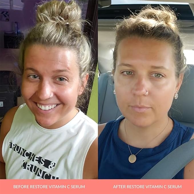 AnnieMak Restore Vitamin C Serum for Face with Hyaluronic Acid, Vitamin E & Patented Ingredients for Skin Tightening & Brightening, Facial Skincare for Fine Line & Wrinkle, Promotes Collagen (1 fl oz)