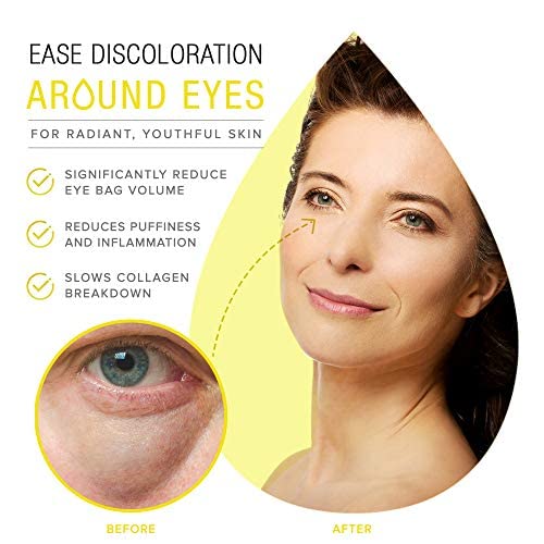 Extreme Dark Circle Serum - Under Eye Treatment for Dark Circles, Puffiness, Wrinkles & Fine Lines - Revitalizing, Anti-Aging & Eye Depuffer Serum for Eye Skin Care l 30 ml