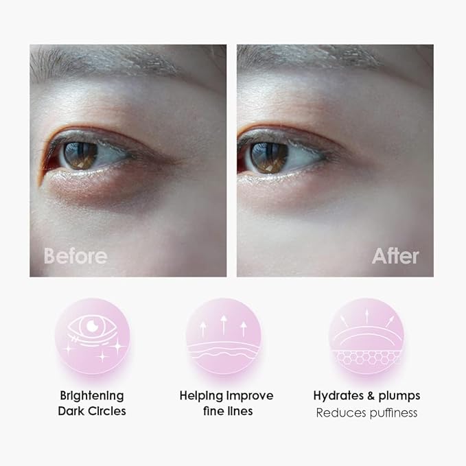 Sweet Dreams Collagen Glow Rose Gold Eye Masks l Under Eye Patches for Self Care Under Eye Patches Wrinkle Patches l Dark Circles Treatments - Collagen, Niacinamide, Hyaluronic aid, Peptides
