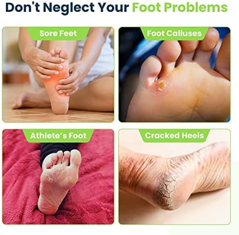 Tea Tree Oil Foot Balm - Foot Moisturizer for Dry Cracked Feet - Instantly Hydrates & Soothes Irritated Skin & Athletes Foot - Best Foot Care for Women and Men & Tea Tree Foot Soak, Callus Remover Gel