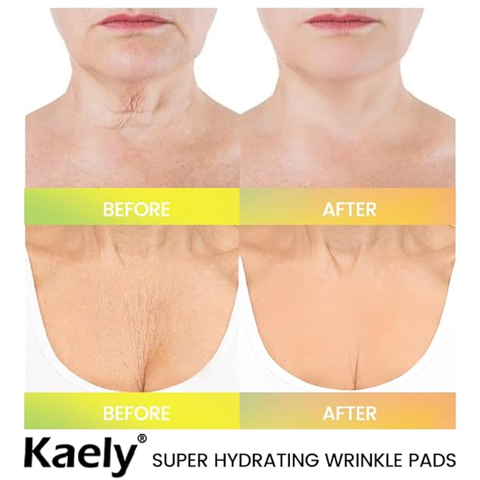 evpct 2Pcs Silicone Chest Smoothing Wrinkle Pads Reusable, Silicone Anti Chest Wrinkle Patches Reusable for Chest Wrinkles Overnight, Décolleté Chest Wrinkle Pillow Pads for Smoother,SizeL-T Type&Neck