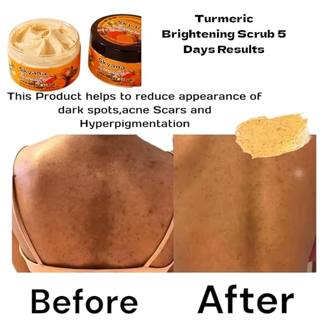 Organic Lemon&turmeric Shea Sugar Scrub with Collagen, Vitamin C, 250g, Brightening Body and face Scrub.Anti-oxidation removal pimples.Exfoliator.