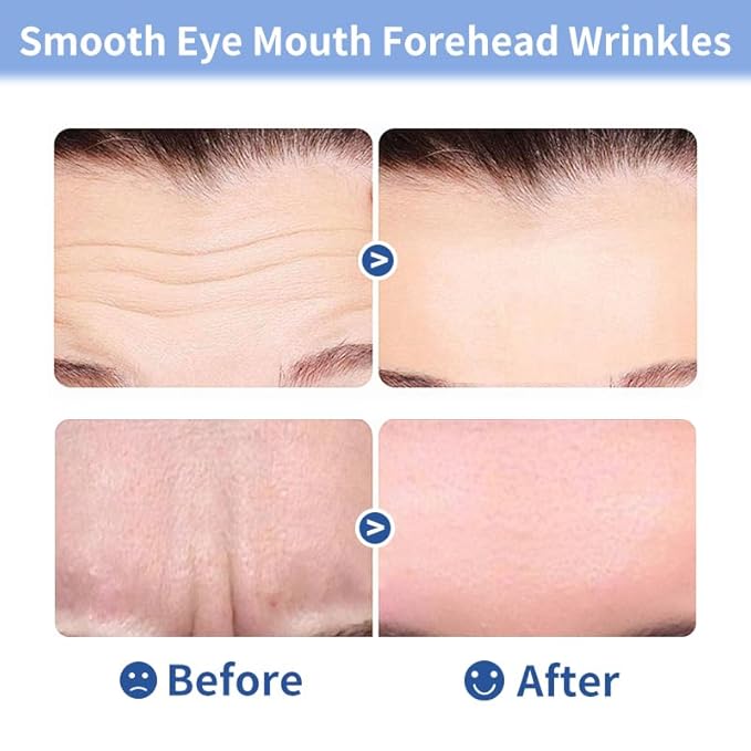 20pcs Masks | Collagen Forehead Anti-Wrinkle Treatments | Jelly Touch Mask | Skin-Friendly Hydrogel for Deep Hydration, Firming & Fine Line Reduction, Targets Forehead Wrinkles & Frown Lines