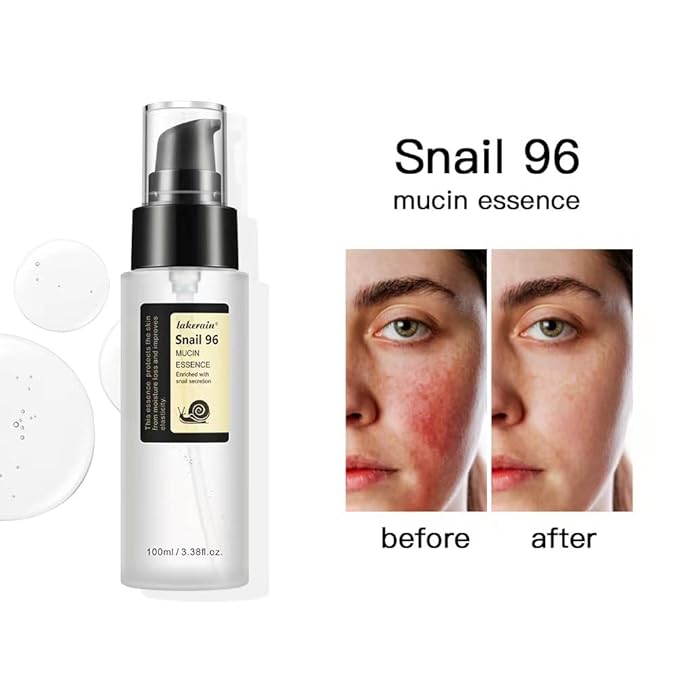 100ML Snail Mucin Serum,96% Advanced Snail Mucin Power Essence,Snail Mucin Repair Dark Spots,Hydrating and Moisturizing Snail 96%,Snail Mucin Essence for Face,Improve Skin Vitality