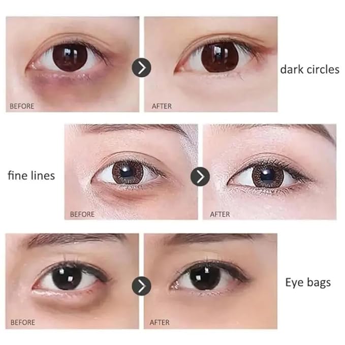 Retinol Anti-Wrinkle Eye Serum Oil, Eye Oil Roller, Reduces Fine Lines, Anti Wrinkle Serum For Eye