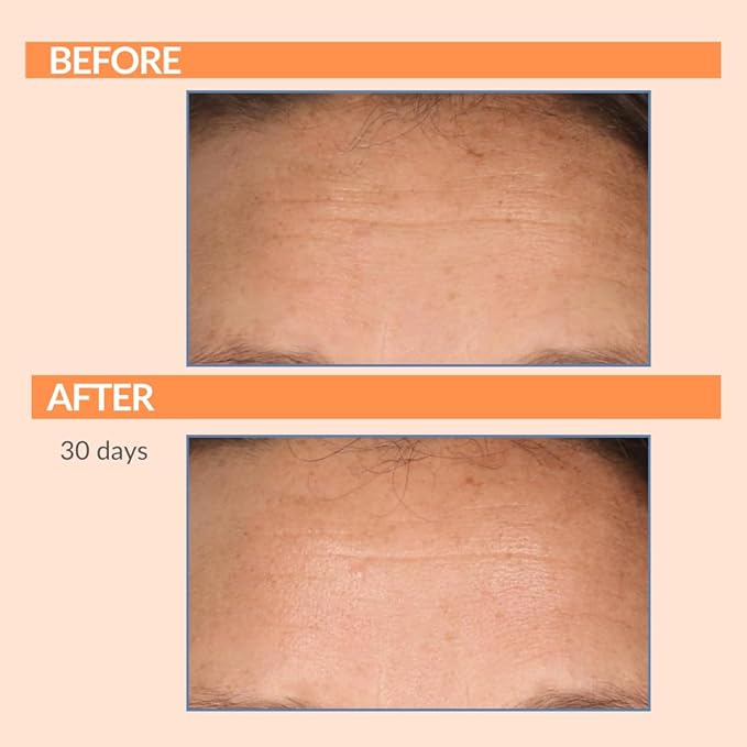 Serious Skincare - Vitamin C Day & Night Skin Care Set - Brightening Face Serum, Daytime SPF Moisturizer, Restore Night Cream, Face Wash - C3 C Esters for Hydrating, Fine Lines and Wrinkles (4Pack)