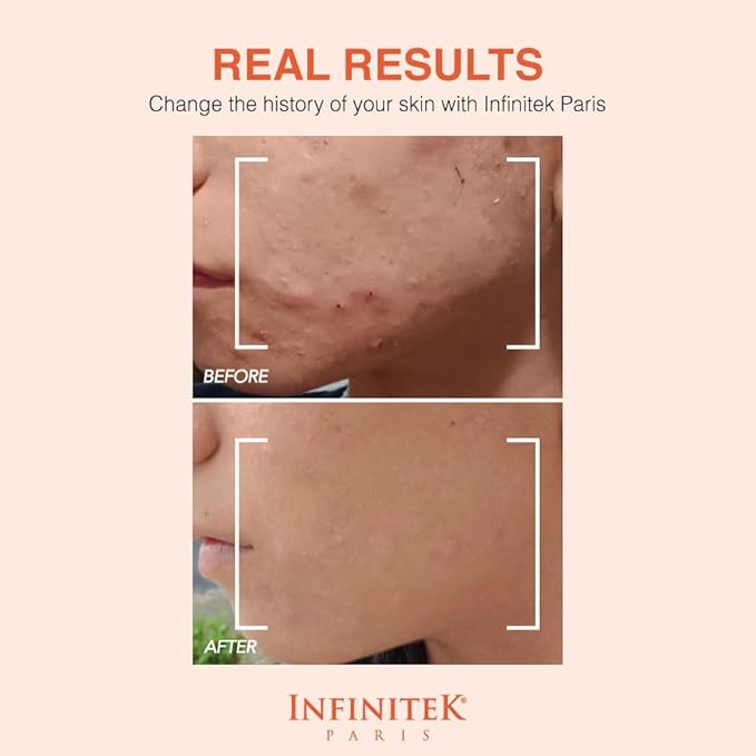 Infinitek Paris Vitamin C Face Serum - Hydrating and Brightening Antioxidant Skincare with Green Tea and Ginseng - Premium Vitamin C Facial Serum with Hyaluronic Acid for Radiant Skin and Anti Aging