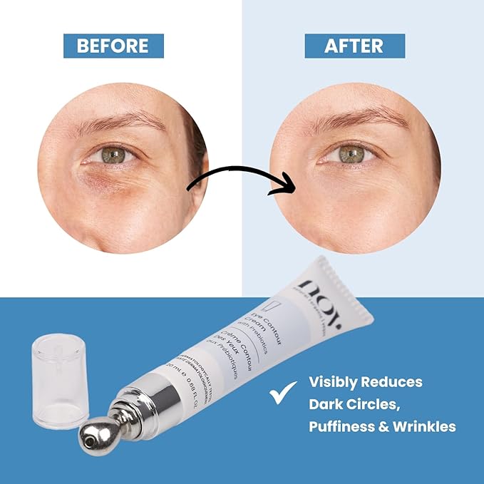 Natural Organic Vegan Eye Cream | Eye Cream for Dark Circles and Puffiness Cream for Eye Bags and Dark Circles Under Eye Contour Cream with Prebiotics 0,68 Oz Dermatologically Tested