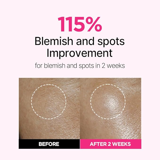 ISOI Blemish Care Up Serum Triple Set, Korean Skin Care for Glass Skin Radiance, Includes 2 Full Size & 1 Refill Serums, Eye & Wrinkle Patch Tester, Daily Hydration Gift Set (2.13 fl. oz)