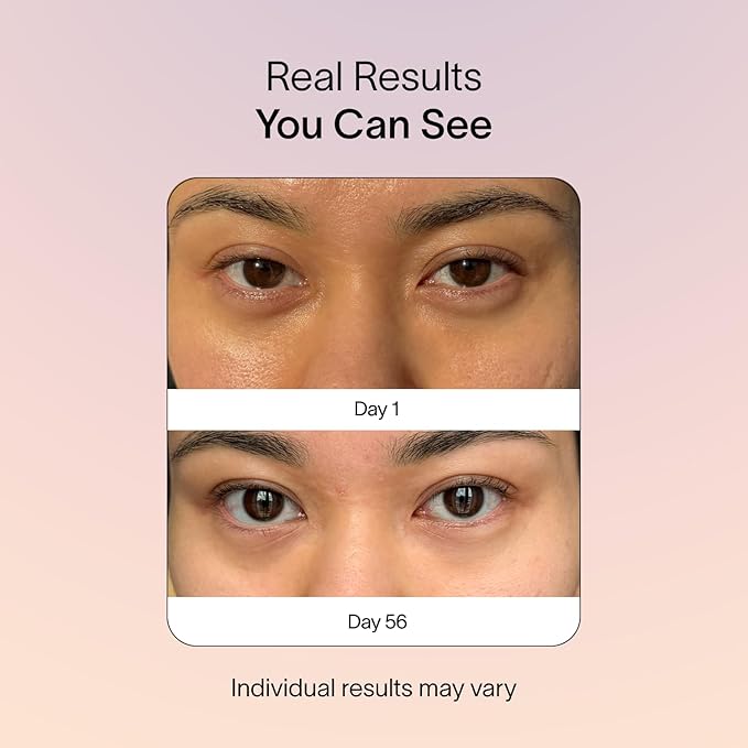 Solawave Eye Recovery Pro | FDA Cleared Red and Infrared Light Therapy for Under-Eye Wrinkles, Forehead Lines, 11s, Crow's Feet, Dark Circles | Anti-Aging Eye Mask with Hands-Free Light