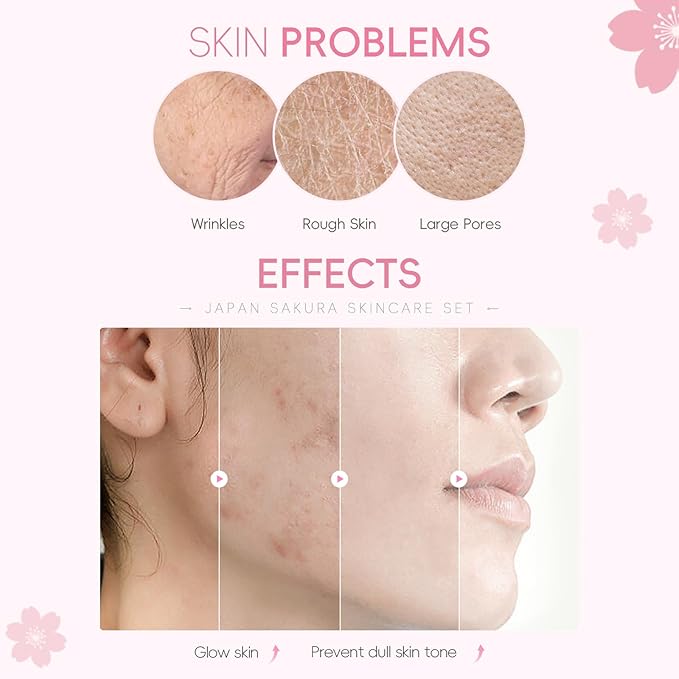 Sakura Skincare Set for Teen Girls, Complete 34PCS Face Care Kit, Christmas Pamper Gift Set for Women & Teenage Girls, Hydrating & Nourishing Travel-Friendly Daily Facial Skincare Routine