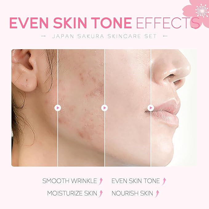 SAKURA Skin Care Set, Skin Care Sets & Kits Women Girls Gift Set with Cleanser, Face Serum, Face Cream, Toner, Eye Cream, Travel Size Skincare Set for Women Teen Girls Birthday Christmas Gift (SAKURA)
