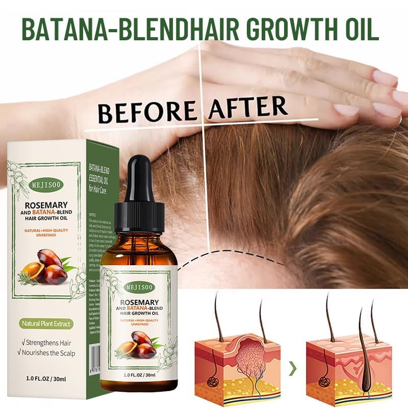 2 Pack Organic Batana Rosemary Oil for Hair Growth & Anti-Hair Loss, 2PCS 1 fl oz Natural DHT Blocker Scalp Treatment for Thinning Hair, Nourishing Dry Scalp & Strengthening Follicles