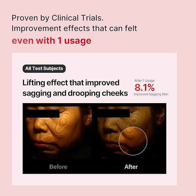 Shumage Gold Seal Lifting Cream+Device & Shumage Shot Gold Seal Lifting Ampoule - Moisturizer Face Lift Cream, Hydrating & Tightening for Sagging Skin - Collagen Serum for Radiant Glow