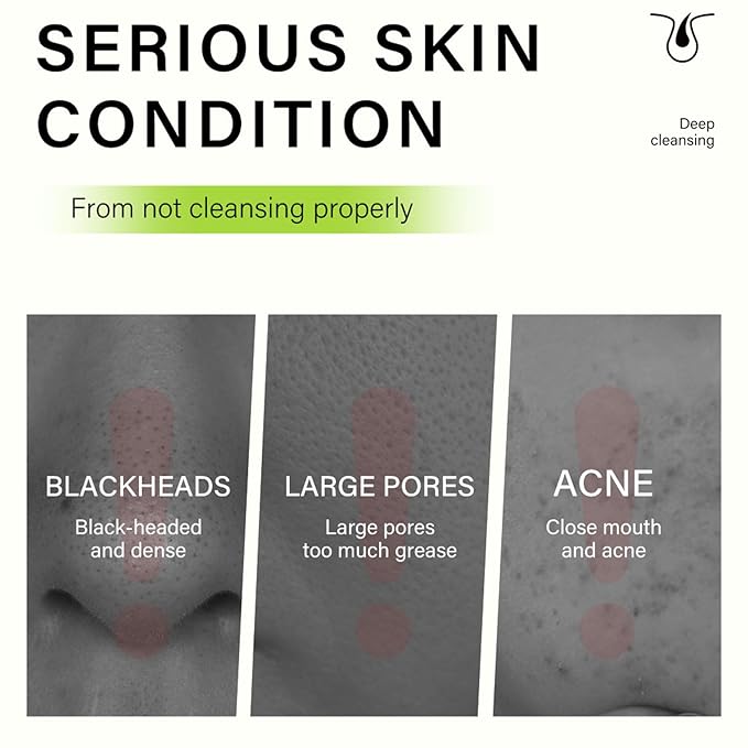 Blackhead Remover Mask, Charcoal Peel Off Face Mask, Purifying & Deep Cleaning Pore, Reduce Nose Face Blackhead, Excess Oil, Blackhead Peel off Masks for Women and Men