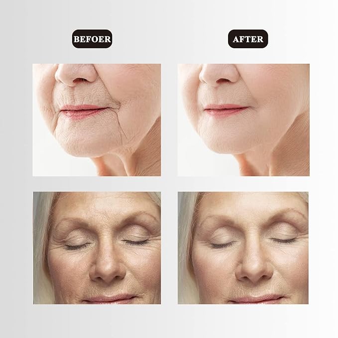 Ms.W Red Light Face Massager Electric Face Lifting, Facial Massager for Skin Care with LED, Heated, and Vibration,Tightenings and Rejuvenation for Face and Neck