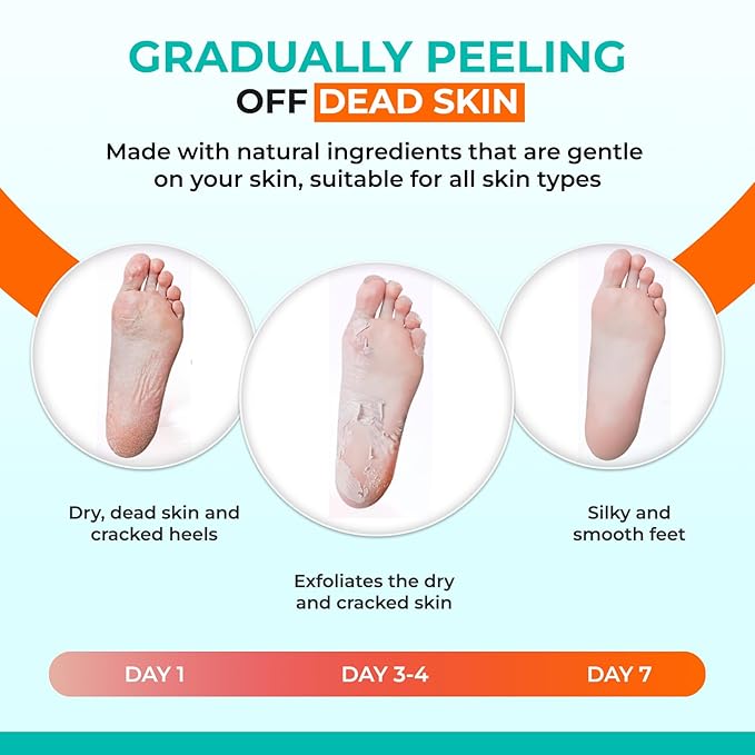 Happy Feet Foot Peel Mask Coconut, 03 Packs Original Exfoliant Foot Peel Mask, Callus Remover for Rough Cracked Dry Feet Dead Skin