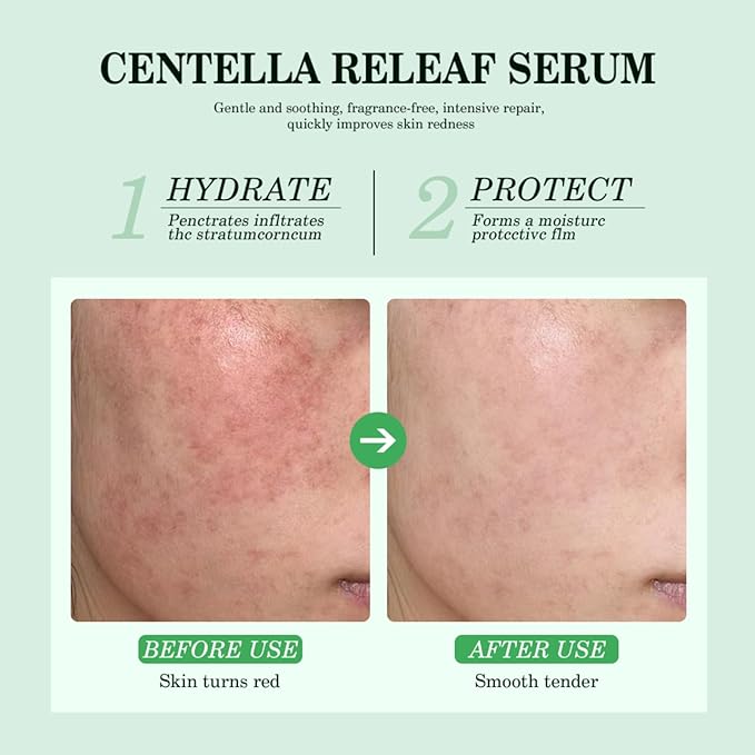 NICEFACE Centella Releaf Serum, Soothing, Calming, Facial Serum for face, Vegan & Cruelty-Free