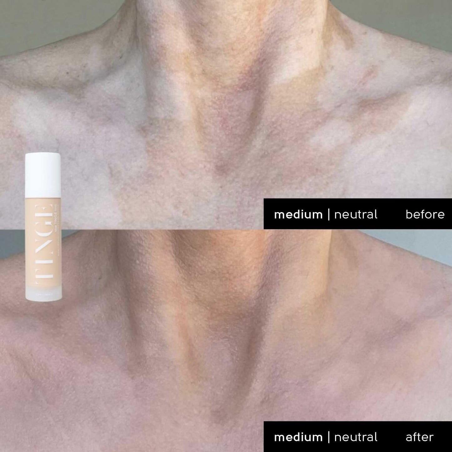 Tinge Tint Body Makeup, Lasts Up to 48 Hours, Medium Coverage With Amino Acids, Hyaluronic Acid & Lysine, Semi Matte Finish, Water & Transfer Resistant, 3.38 Fl Oz - Medium Neutral