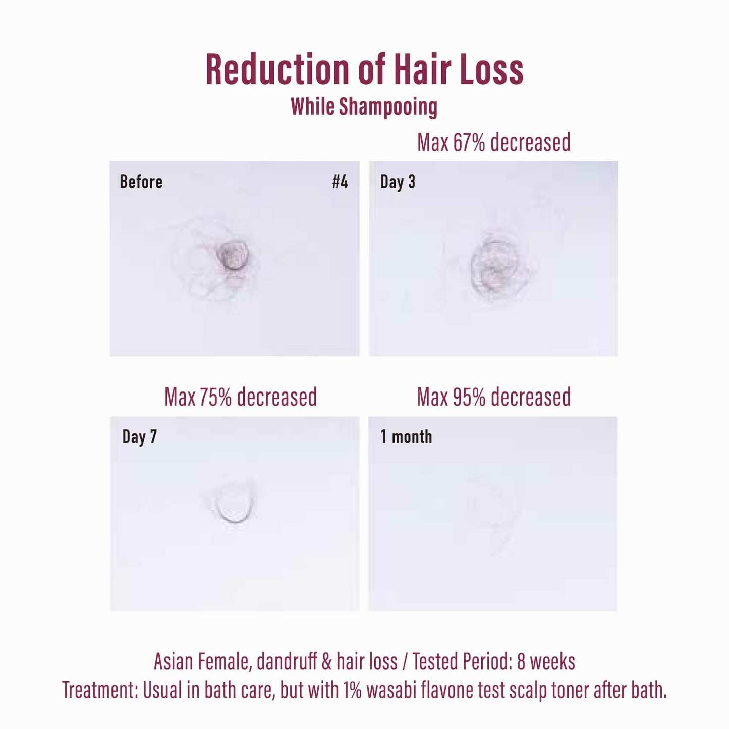 Moist Diane Thickening Conditioner for Men, Dry Itchy Scalp Treatment by Keratin, Ginseng Root & Protein, Argan Oil Conditioner for Women from Japan, 15.2 Fl Oz, EXTRA HAIR FALL CONTROL