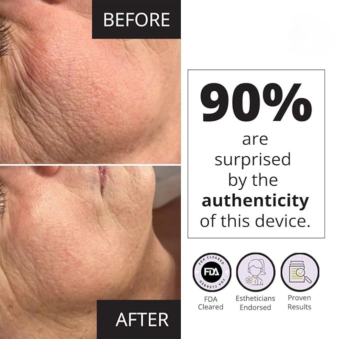 7E Wellness MyoLift Mini Microcurrent Facial Device - Non-Invasive Face Lift, Facial Skin Care Products for Anti Aging, Skin Tightening - Esthetician Supplies and Skin Care Tools - Up to 400 Microamps