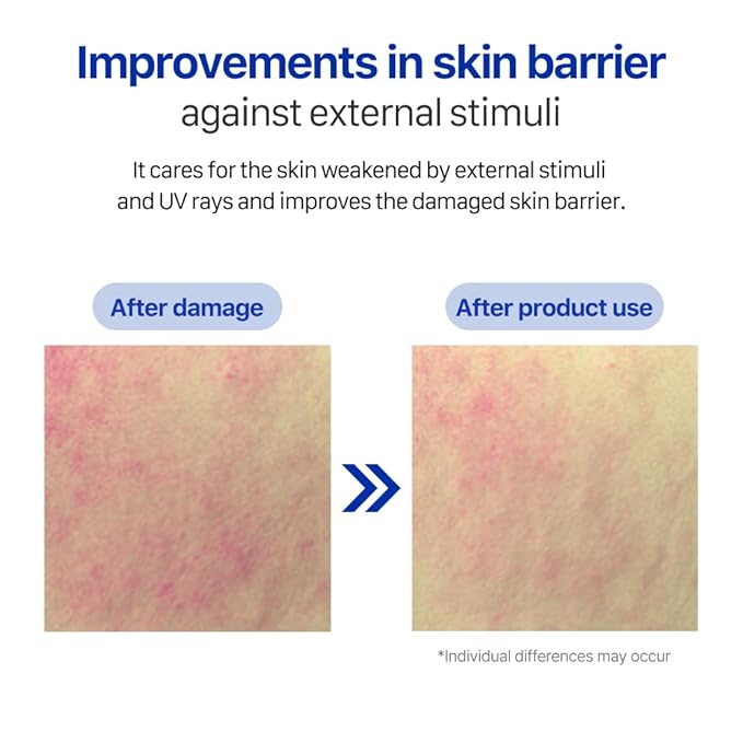 Real Barrier | Extreme Cream Face Sheet Mask | Skin Barrier Repair | Face Masks Skincare | Moisturizing & Hydrating for Dry and Sensitive Facial Types | Facial Moisturizer | Korean Mask | 10 Sheets