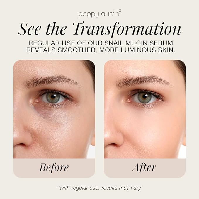 96% Snail Mucin Serum with Niacinamide, Snail Serum for Face, Hydrating Serum Snail Mucin Essence Face Serums for Anti Aging Serum (3.34 Fluid Ounces)