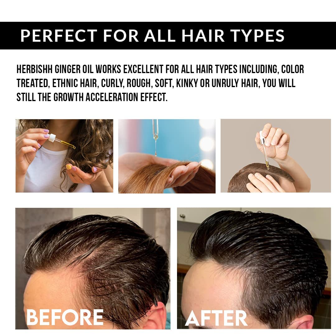 Herbishh Ginger Essential Oil for Hair Growth 30ml - Pack of 3, Non-Sticky Serum for Thicker, Strong and Glossier Hair With Dropper