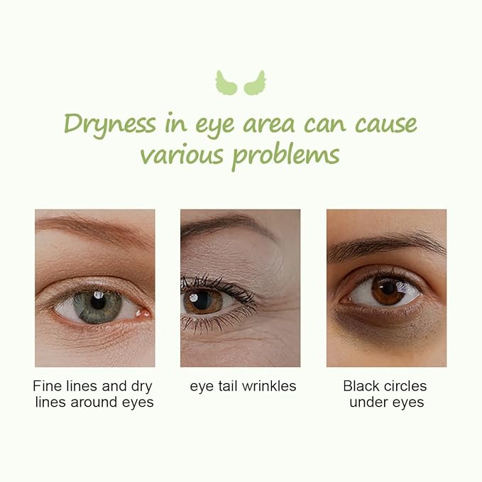 12Pcs Under Eye Patches for Dark Circle, Cucumber Moisturizing Hyaluronic Acid Eye Mask, Crystal Angle Wings Mask, Hrydrate & Moisture Gel Under Eye Treatment Skin Care Products (Cucumber)